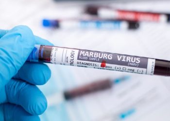 Six Lives Lost as Marburg Outbreak Strikes Rwanda