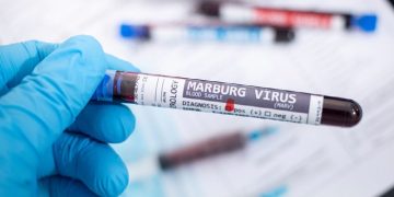Six Lives Lost as Marburg Outbreak Strikes Rwanda