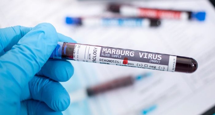 Six Lives Lost as Marburg Outbreak Strikes Rwanda