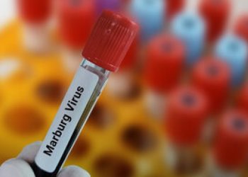 Rwanda Confirms Cases of Deadly Marburg Virus