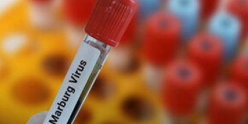 Rwanda Confirms Cases of Deadly Marburg Virus