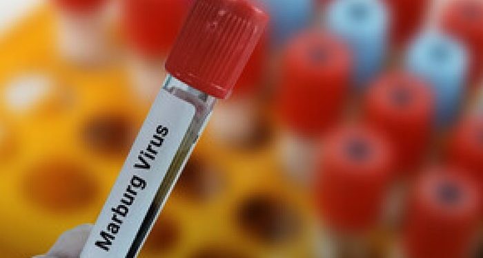 Rwanda Confirms Cases of Deadly Marburg Virus