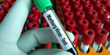 Tanzania Refutes WHO Concerns Over Possible Marburg Outbreak