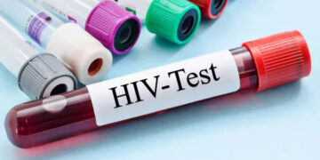 Experts Warn of HIV Reversal in East Africa